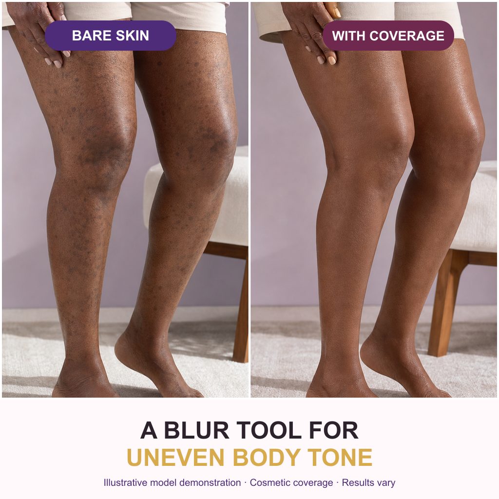 Novima Body Coverage