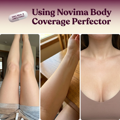 Real results — covered legs, arms and chest using Novima